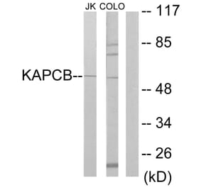 Western Blot - Anti-KAPCB Antibody (C10453) - Antibodies.com