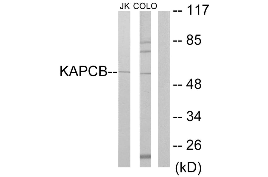 Western Blot - Anti-KAPCB Antibody (C10453) - Antibodies.com