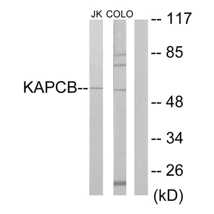 Western Blot - Anti-KAPCB Antibody (C10453) - Antibodies.com