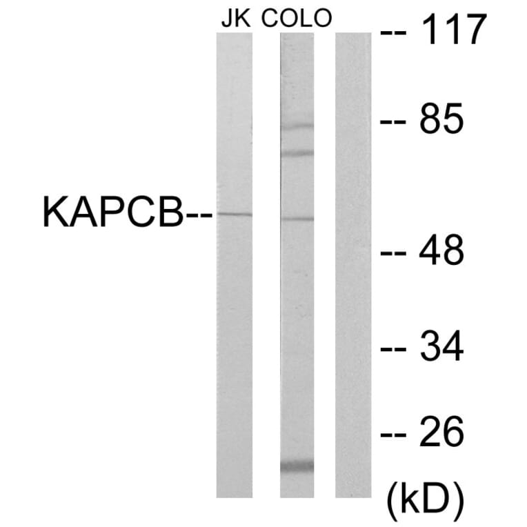 Western Blot - Anti-KAPCB Antibody (C10453) - Antibodies.com
