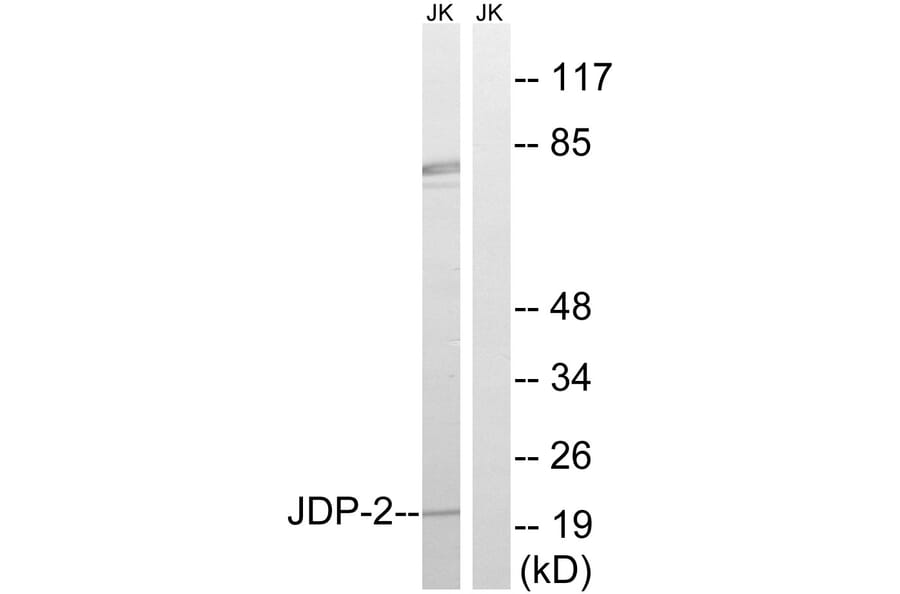 Western Blot - Anti-JDP-2 Antibody (B8356) - Antibodies.com