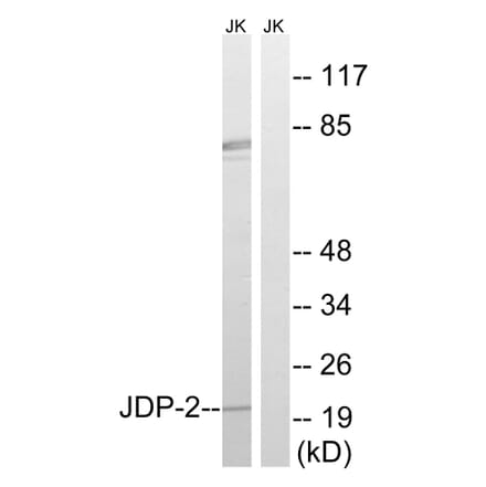 Western Blot - Anti-JDP-2 Antibody (B8356) - Antibodies.com