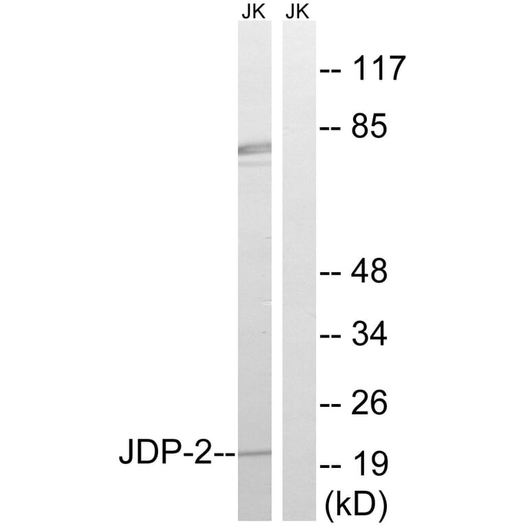 Western Blot - Anti-JDP-2 Antibody (B8356) - Antibodies.com