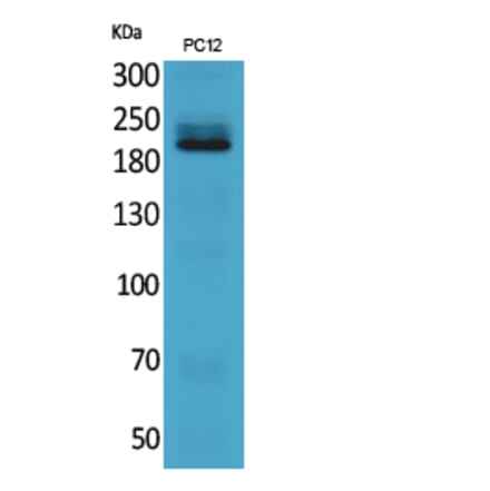 Western Blot - Anti-ITGB4 Antibody (C30408) - Antibodies.com