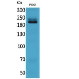 Western Blot - Anti-ITGB4 Antibody (C30408) - Antibodies.com