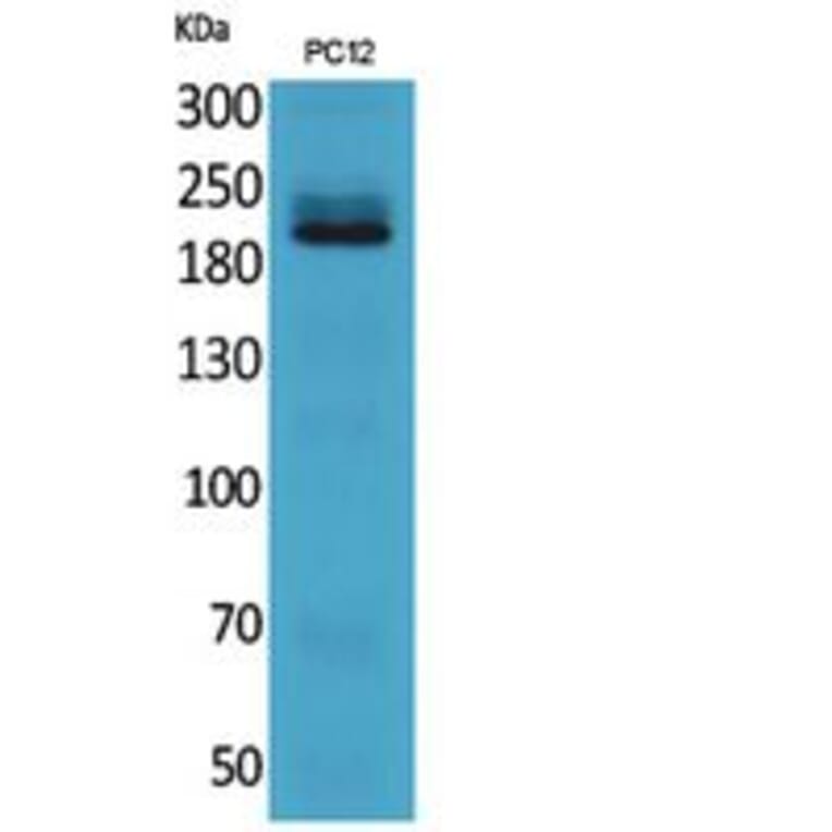 Western Blot - Anti-ITGB4 Antibody (C30408) - Antibodies.com