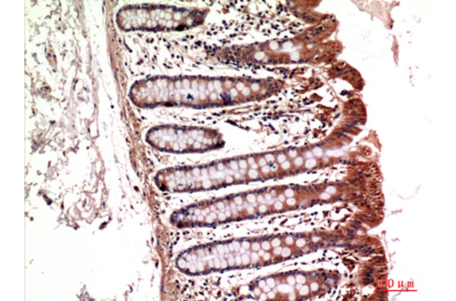 Immunohistochemistry - Anti-ITGA5 Antibody (C30360) - Antibodies.com