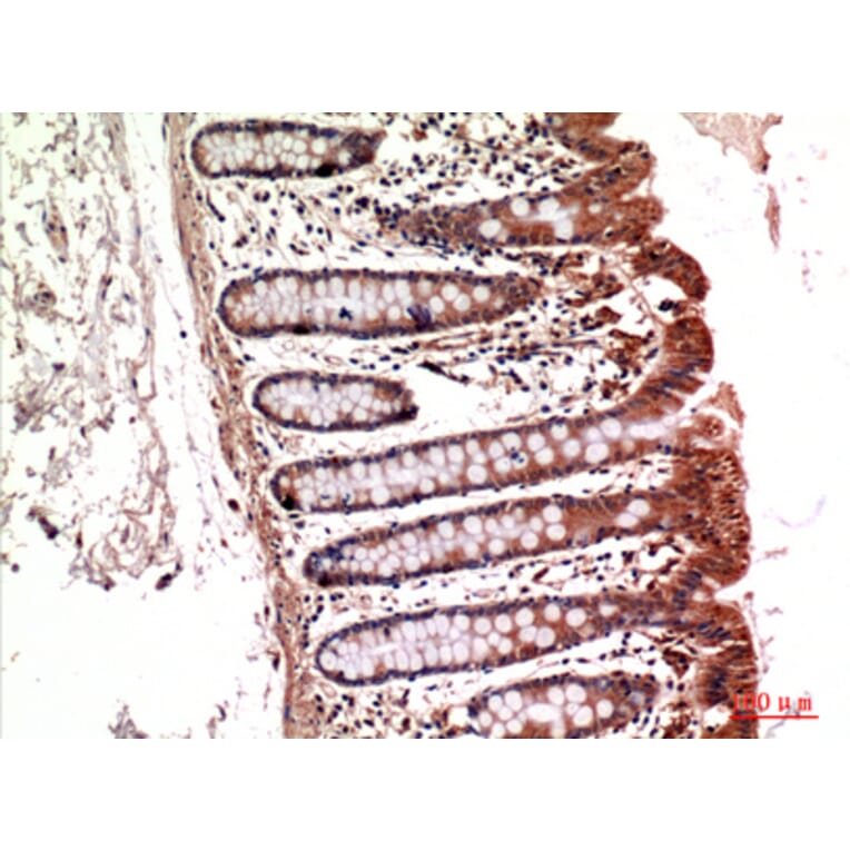 Immunohistochemistry - Anti-ITGA5 Antibody (C30360) - Antibodies.com