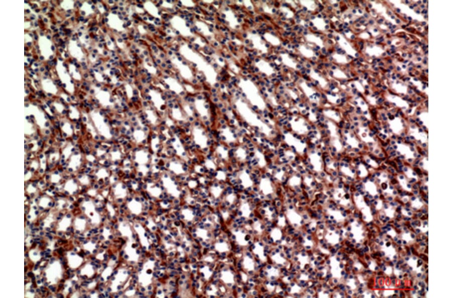 Immunohistochemistry - Anti-ITGA5 Antibody (C30360) - Antibodies.com