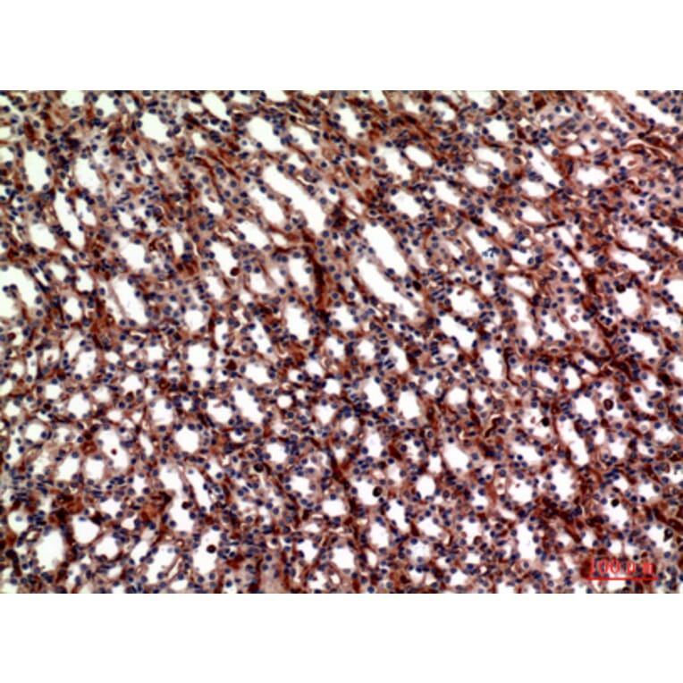 Immunohistochemistry - Anti-ITGA5 Antibody (C30360) - Antibodies.com