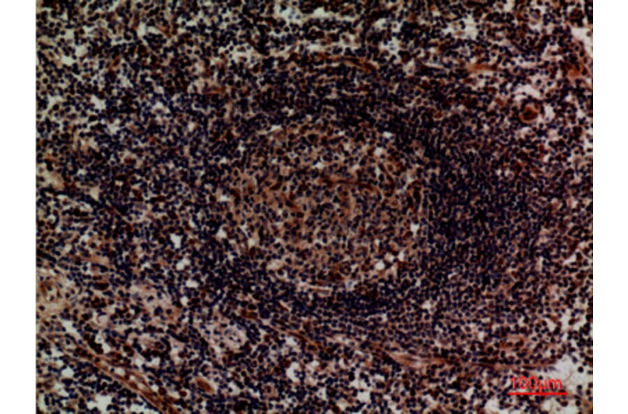 Immunohistochemistry - Anti-ITGA4 Antibody (C30359) - Antibodies.com