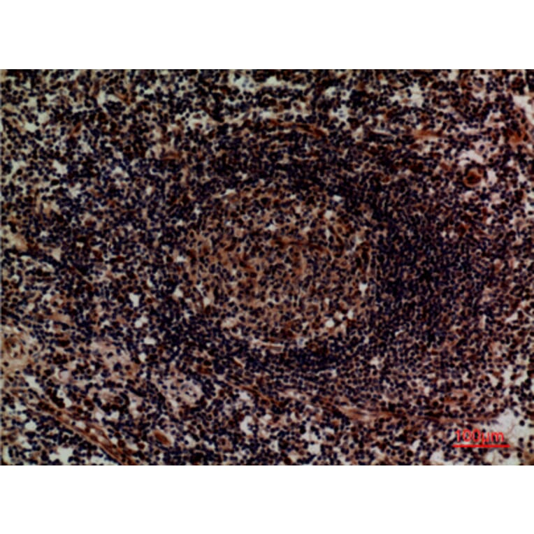 Immunohistochemistry - Anti-ITGA4 Antibody (C30359) - Antibodies.com