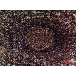 Immunohistochemistry - Anti-ITGA4 Antibody (C30359) - Antibodies.com