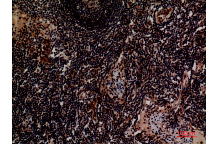 Immunohistochemistry - Anti-ITGA4 Antibody (C30359) - Antibodies.com