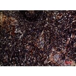 Immunohistochemistry - Anti-ITGA4 Antibody (C30359) - Antibodies.com