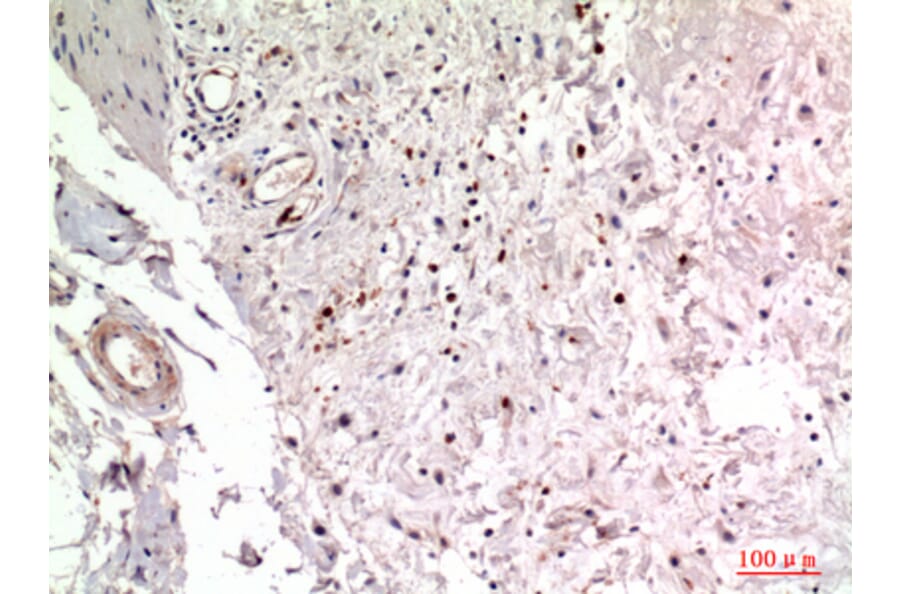 Immunohistochemistry - Anti-ITGA2 Antibody (C30358) - Antibodies.com