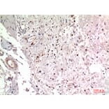 Immunohistochemistry - Anti-ITGA2 Antibody (C30358) - Antibodies.com