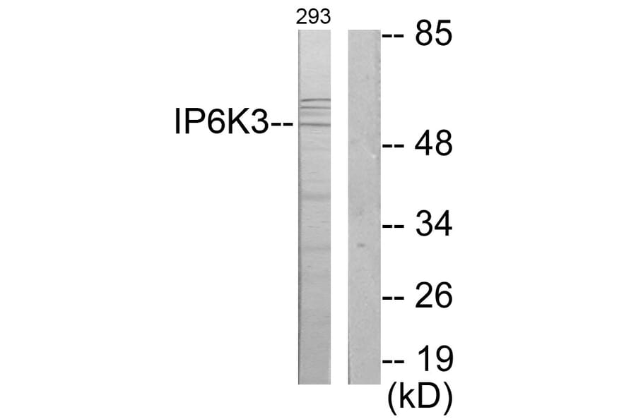 Western Blot - Anti-IP6K3 Antibody (C11523) - Antibodies.com