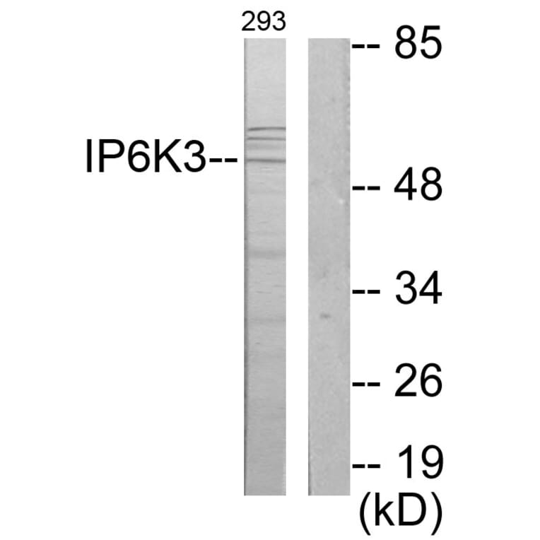 Western Blot - Anti-IP6K3 Antibody (C11523) - Antibodies.com