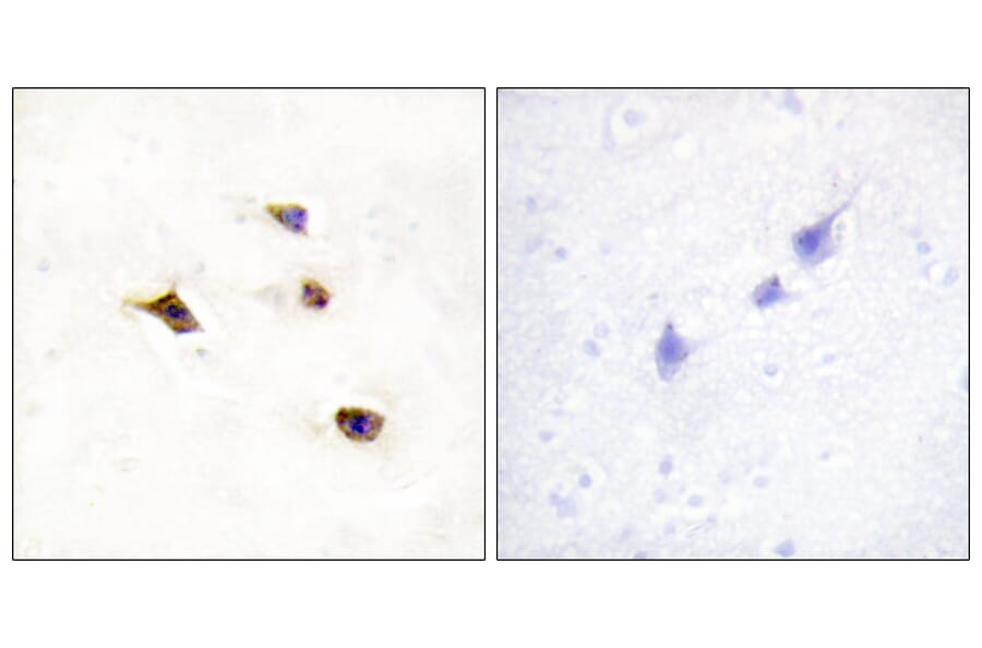 Immunohistochemistry - Anti-IP6K3 Antibody (C11523) - Antibodies.com