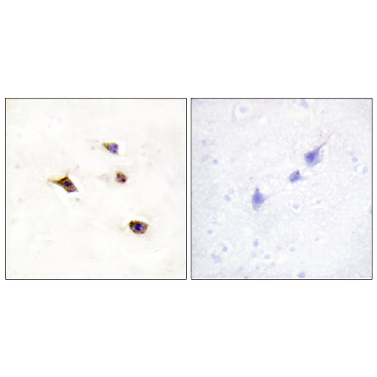 Immunohistochemistry - Anti-IP6K3 Antibody (C11523) - Antibodies.com