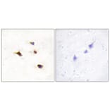 Immunohistochemistry - Anti-IP6K3 Antibody (C11523) - Antibodies.com