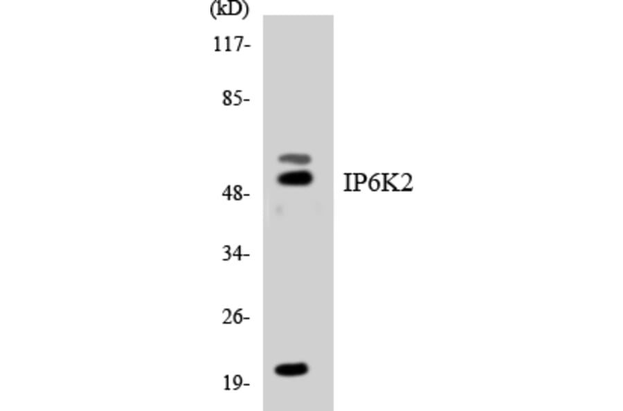 Western Blot - Anti-IP6K2 Antibody (R12-2928) - Antibodies.com
