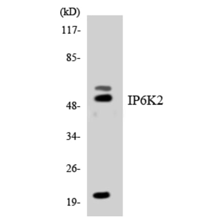 Western Blot - Anti-IP6K2 Antibody (R12-2928) - Antibodies.com