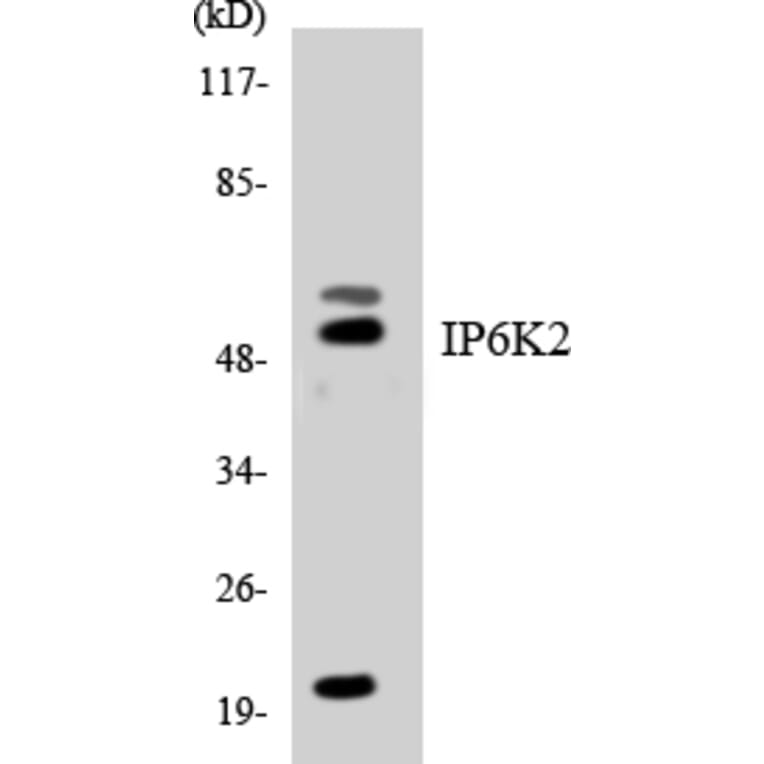 Western Blot - Anti-IP6K2 Antibody (R12-2928) - Antibodies.com