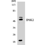 Western Blot - Anti-IP6K2 Antibody (R12-2928) - Antibodies.com