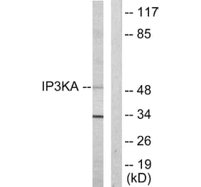 Western Blot - Anti-IP3KA Antibody (C10462) - Antibodies.com