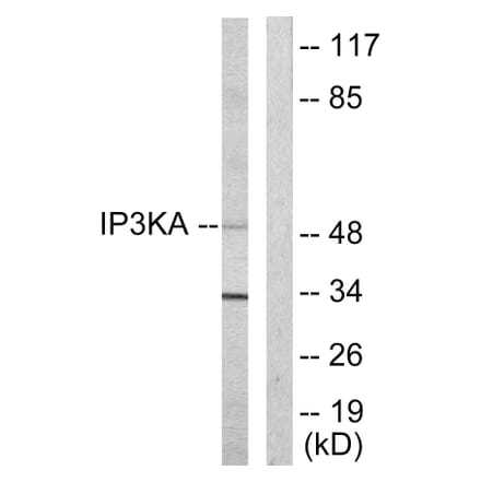 Western Blot - Anti-IP3KA Antibody (C10462) - Antibodies.com
