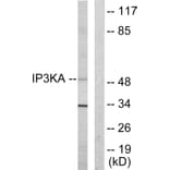 Western Blot - Anti-IP3KA Antibody (C10462) - Antibodies.com