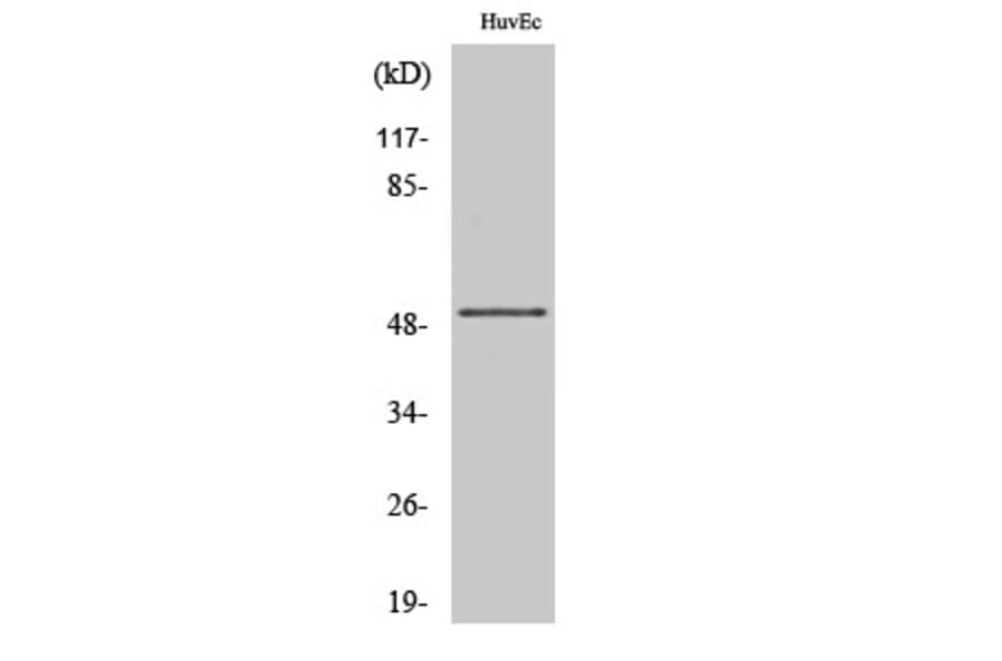 Western Blot - Anti-IP3KA Antibody (C10462) - Antibodies.com