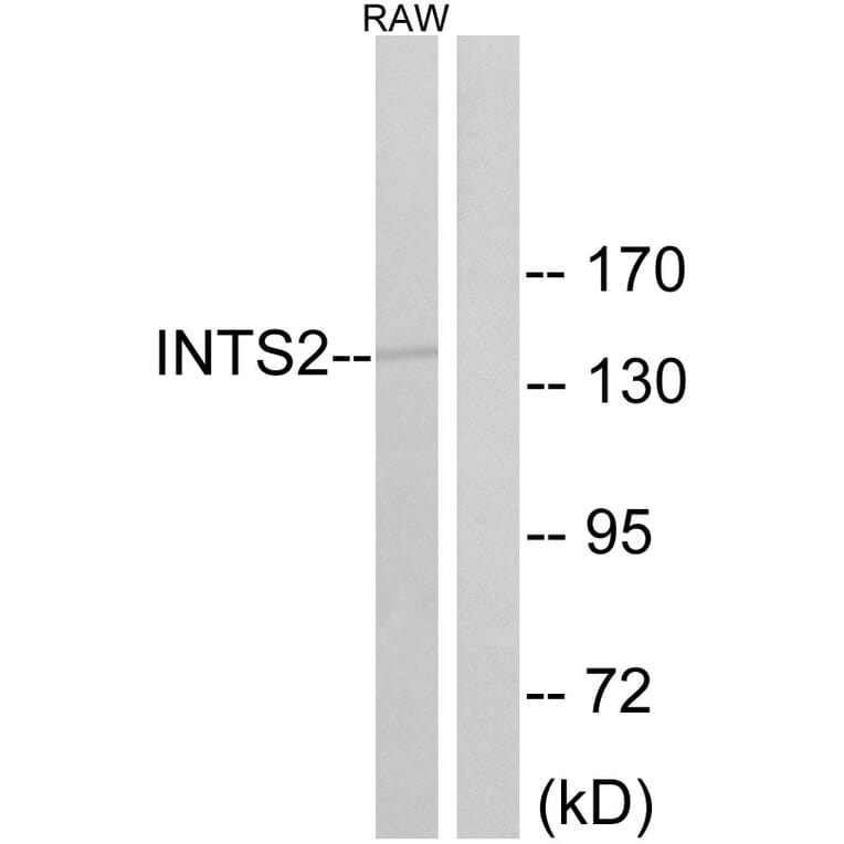 Western Blot - Anti-INTS2 Antibody (C16387) - Antibodies.com