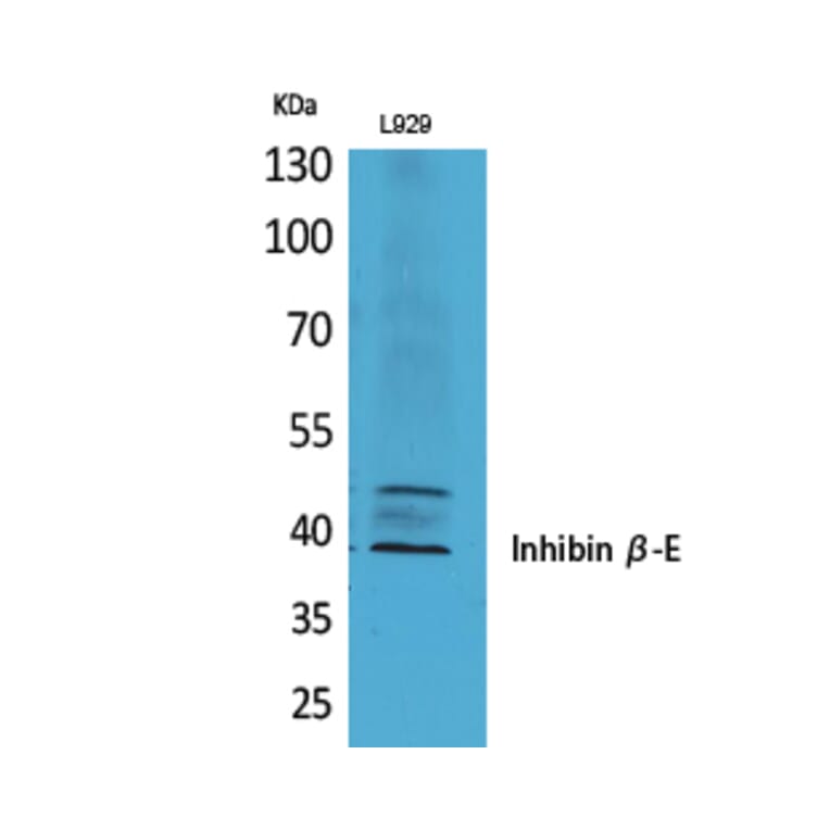 Western Blot - Anti-INHBE Antibody (C30621) - Antibodies.com