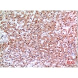 Immunohistochemistry - Anti-INHBE Antibody (C30621) - Antibodies.com