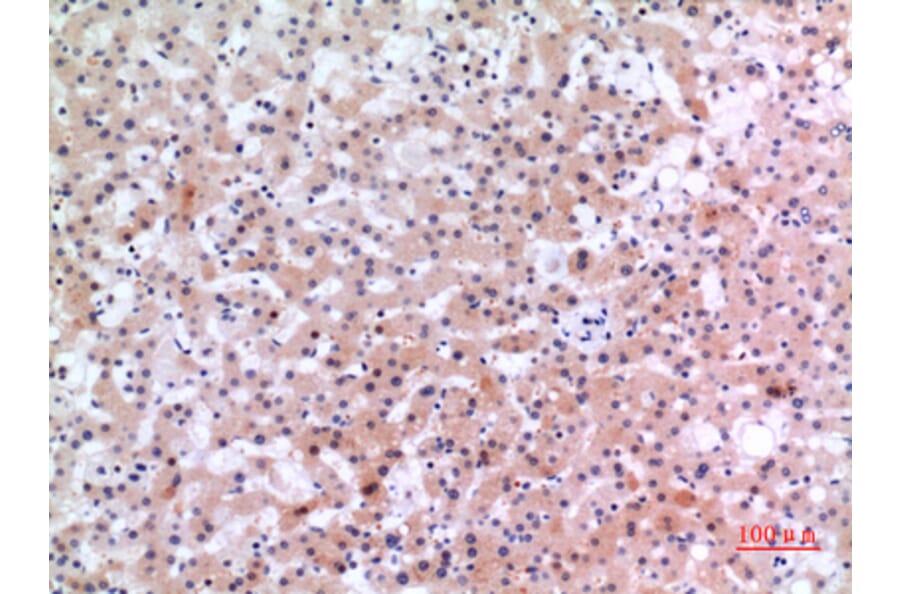 Immunohistochemistry - Anti-INHBE Antibody (C30621) - Antibodies.com