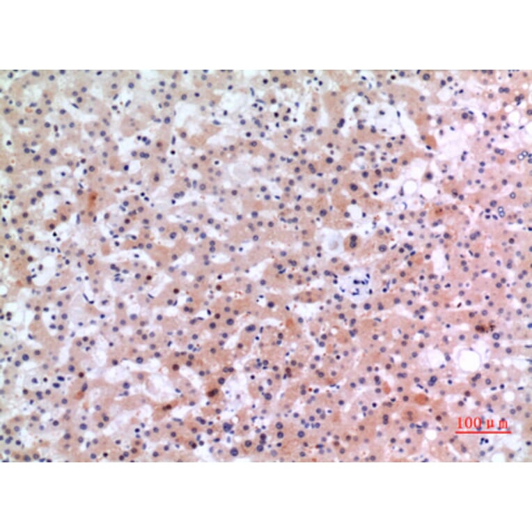 Immunohistochemistry - Anti-INHBE Antibody (C30621) - Antibodies.com