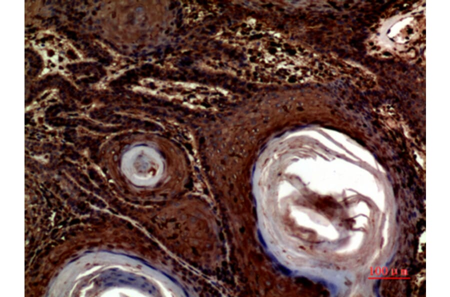 Immunohistochemistry - Anti-INHBA Antibody (C30588) - Antibodies.com