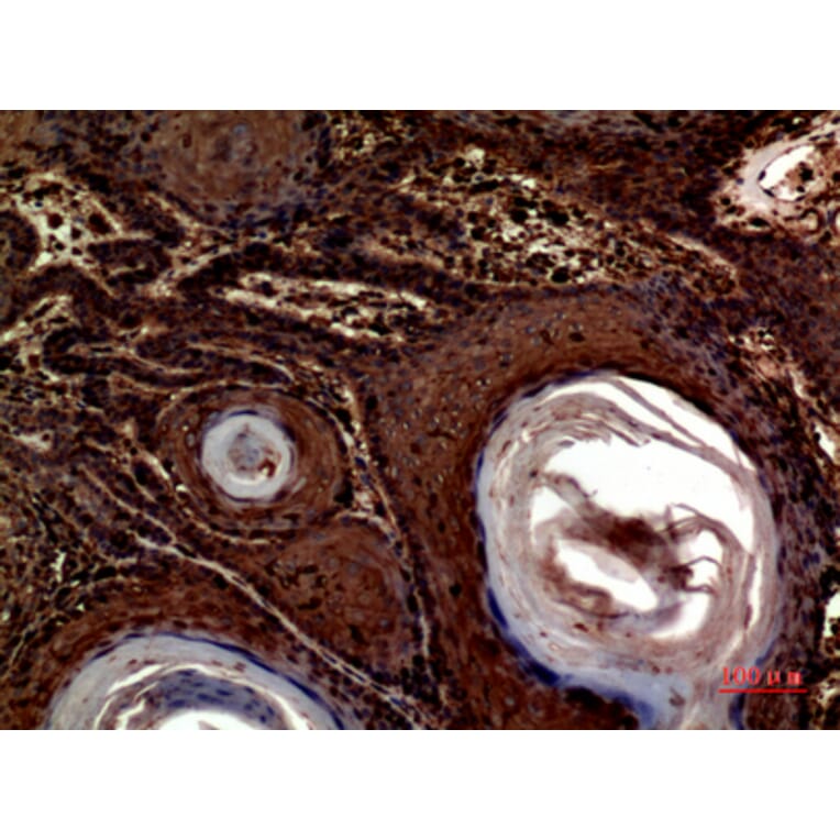 Immunohistochemistry - Anti-INHBA Antibody (C30588) - Antibodies.com