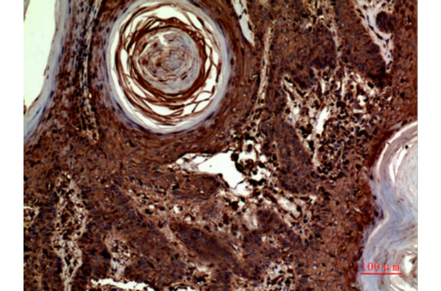 Immunohistochemistry - Anti-INHBA Antibody (C30588) - Antibodies.com