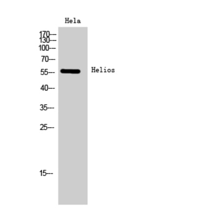 Western Blot - Anti-IKZF2 Antibody (C20569) - Antibodies.com