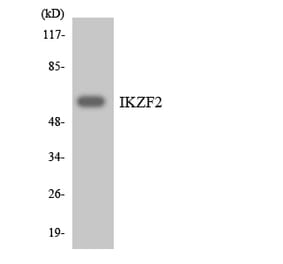 Western Blot - Anti-IKZF2 Antibody (R12-2916) - Antibodies.com