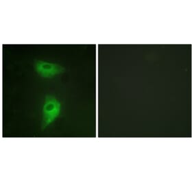Immunofluorescence - Anti-IGF2R Antibody (B1211) - Antibodies.com