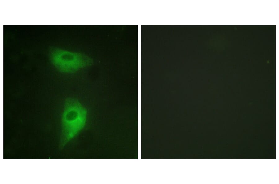 Immunofluorescence - Anti-IGF2R Antibody (B1211) - Antibodies.com