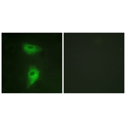 Immunofluorescence - Anti-IGF2R Antibody (B1211) - Antibodies.com
