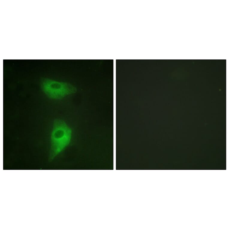 Immunofluorescence - Anti-IGF2R Antibody (B1211) - Antibodies.com