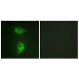 Immunofluorescence - Anti-IGF2R Antibody (B1211) - Antibodies.com