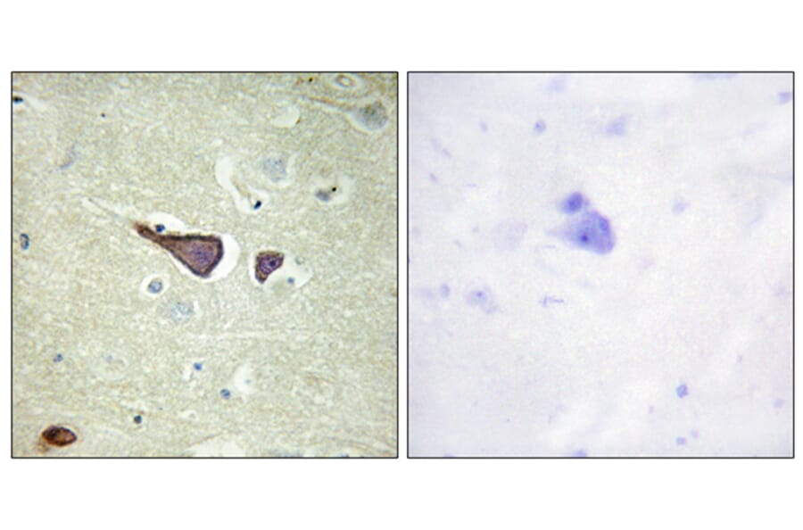 Immunohistochemistry - Anti-IGF2R Antibody (B1211) - Antibodies.com